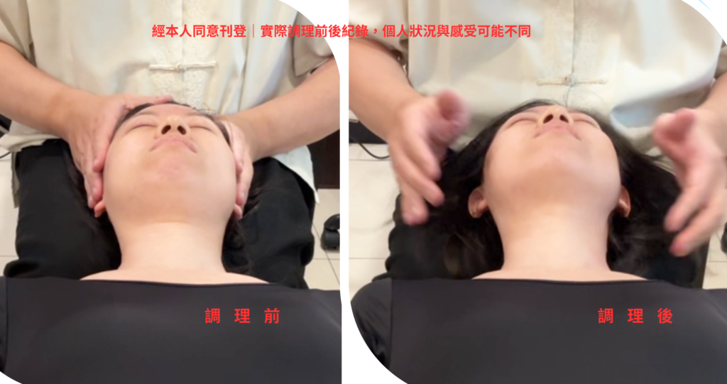 臉型調理前後|美顏平衡實際案例 臉型調理前後實際案例,左右臉輪廓與下顎線比較